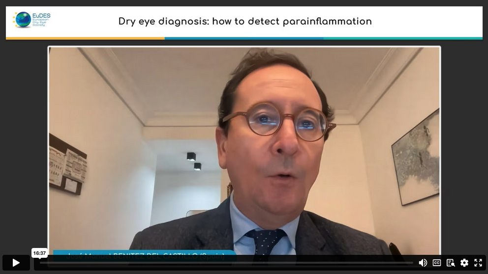 Dry eye diagnosis : how to detect parainflammation